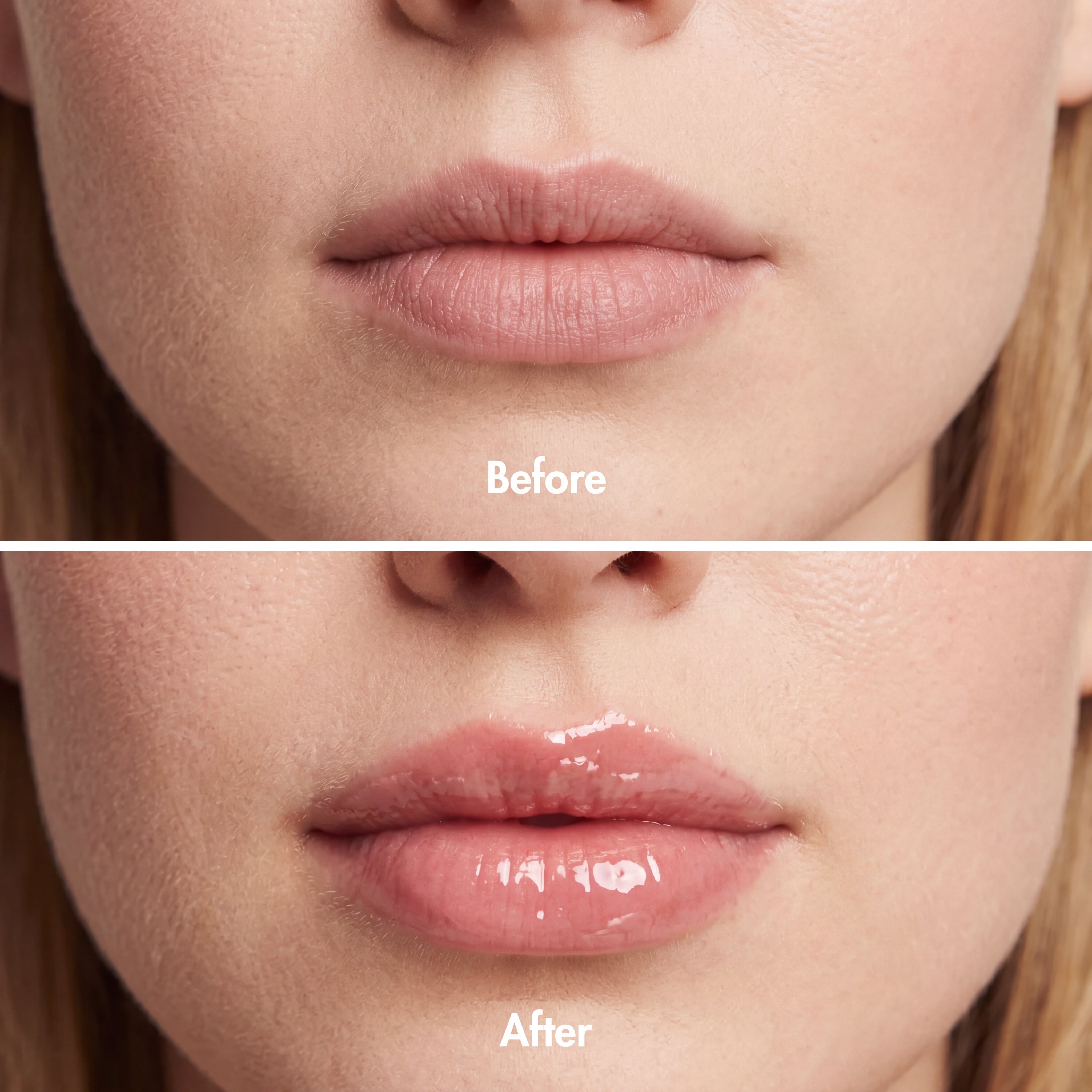 Lip Plumper
